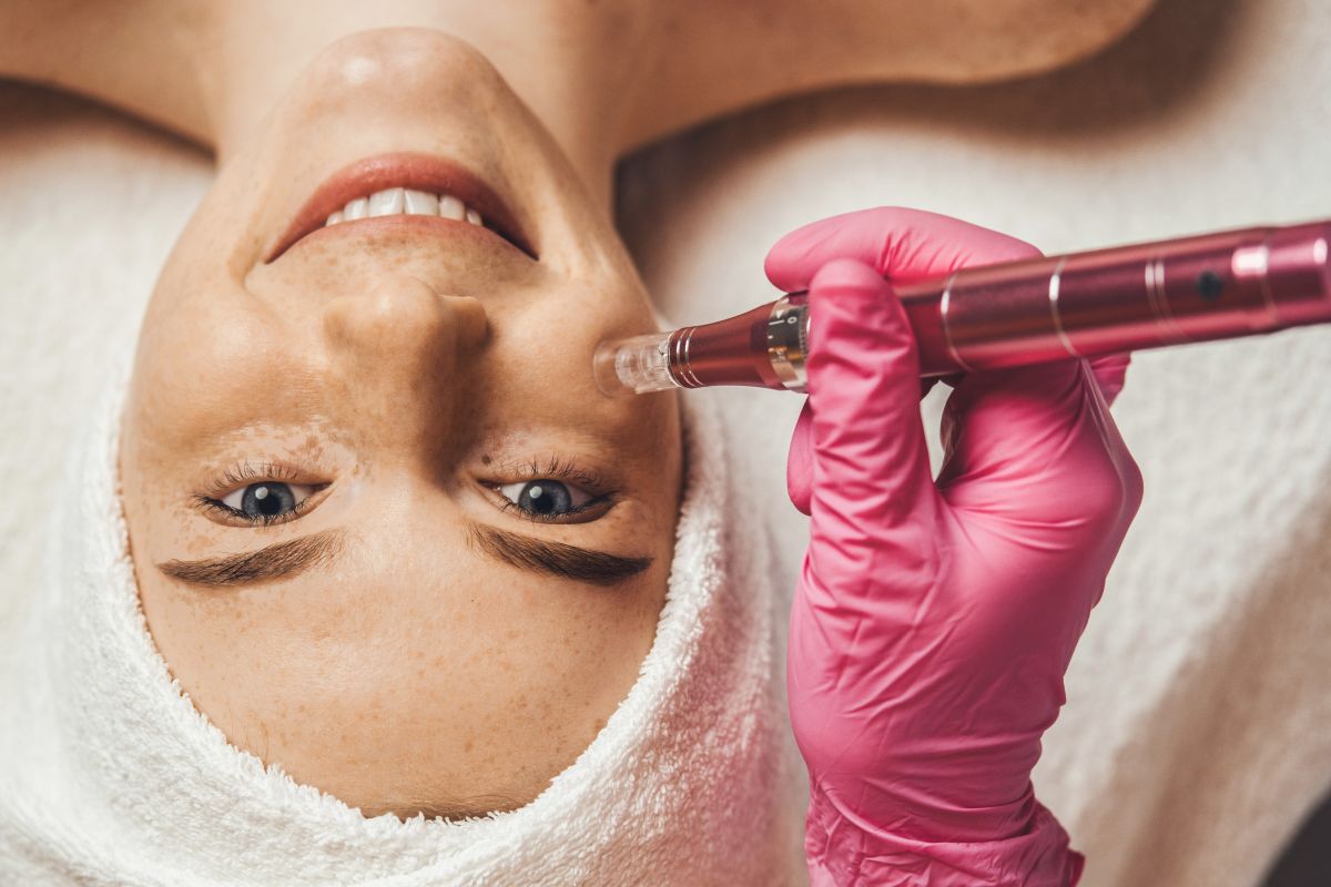 woman gets microneedling treatment